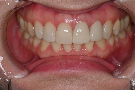 Key Criteria to Know Before Comparing Laminate Prices | OBZERO image 23