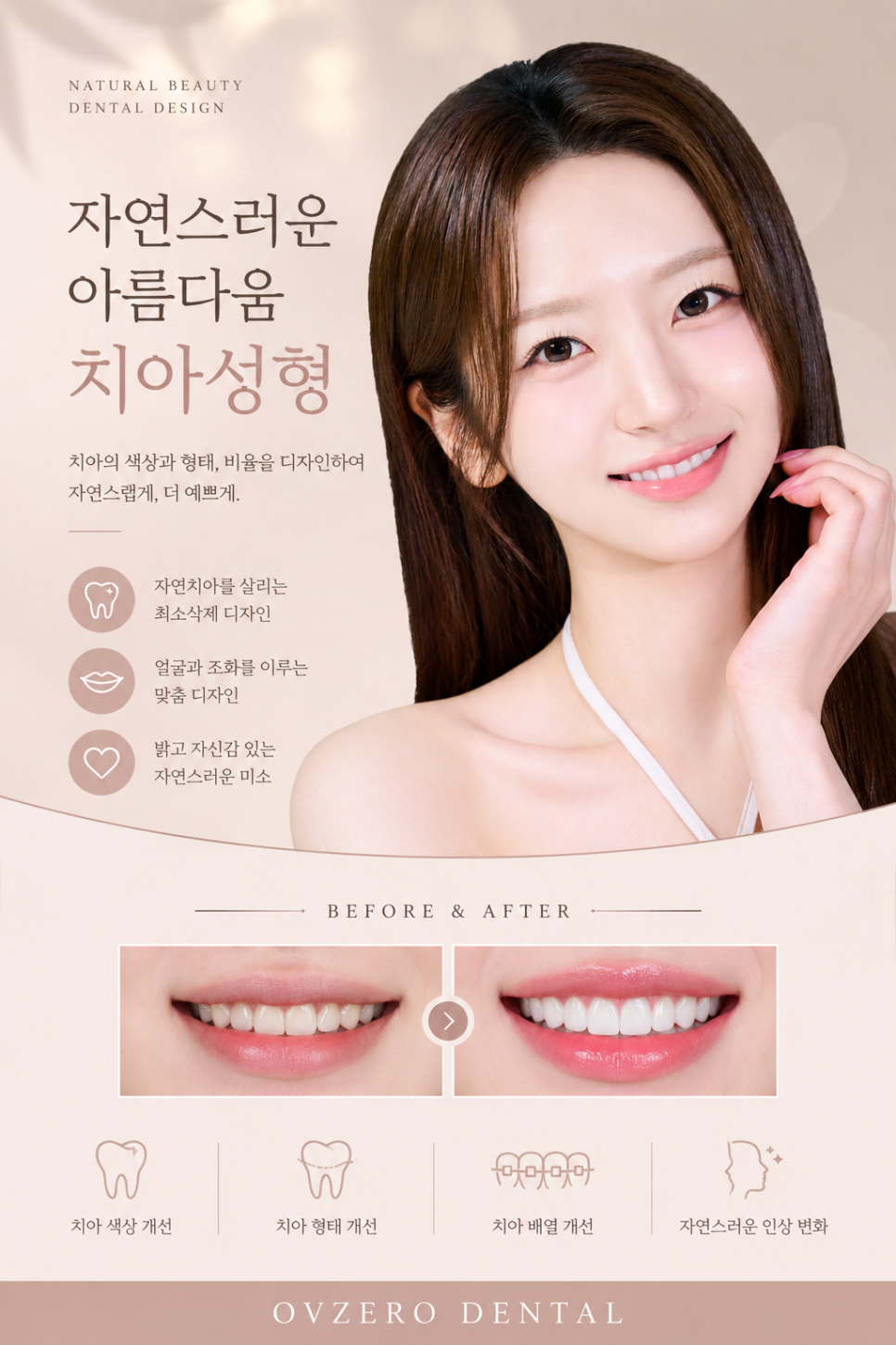 치아성형가격 고민이라면, 치아성형치과 선택 기준 확인 관련 이미지 3
