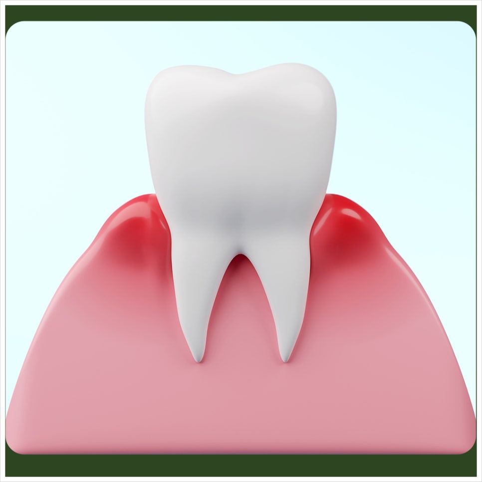 Pregnancy gingivitis may be difficult, but it needs to be managed! image 3