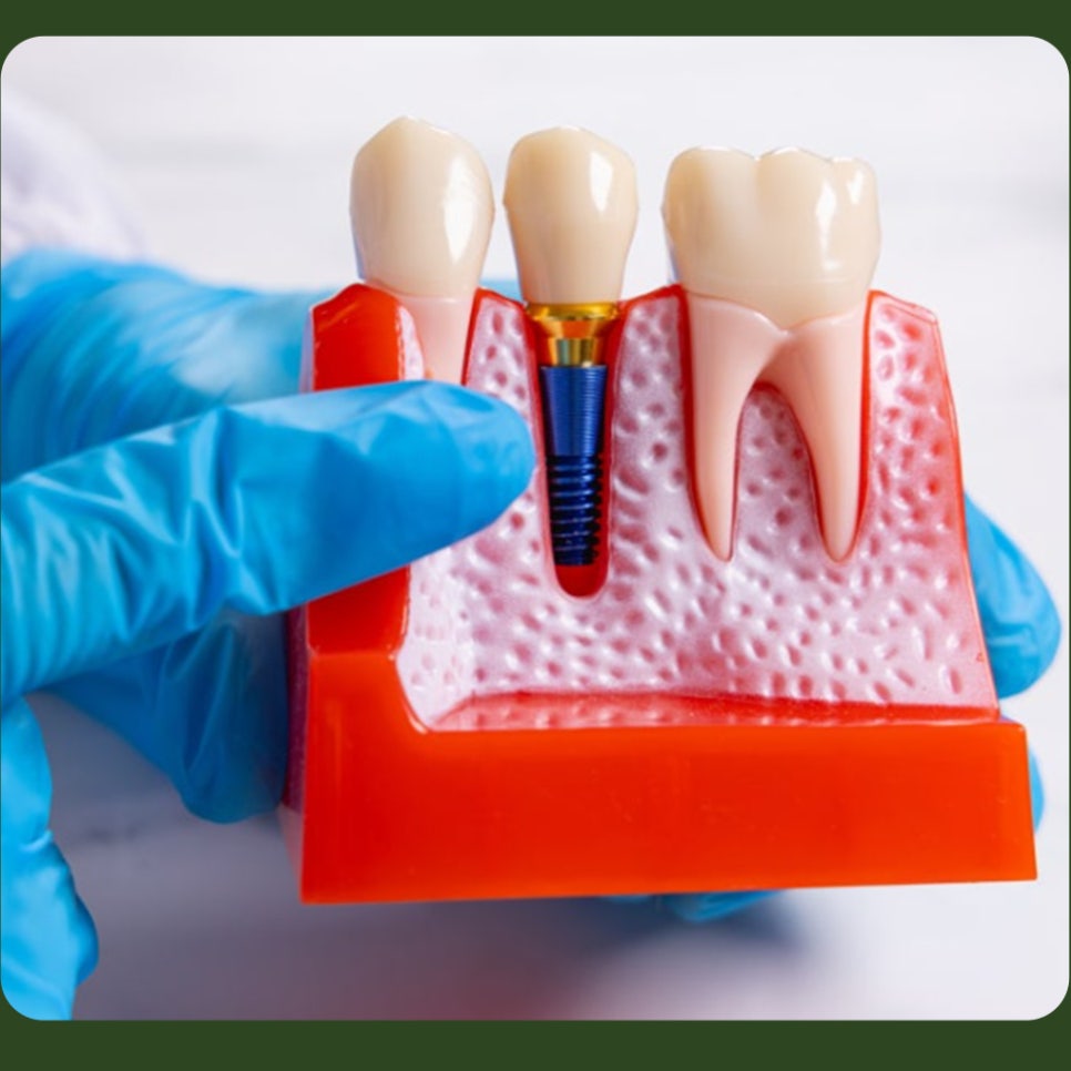 Post-Implant Care Instructions—Let’s Take a Look Together! image 5