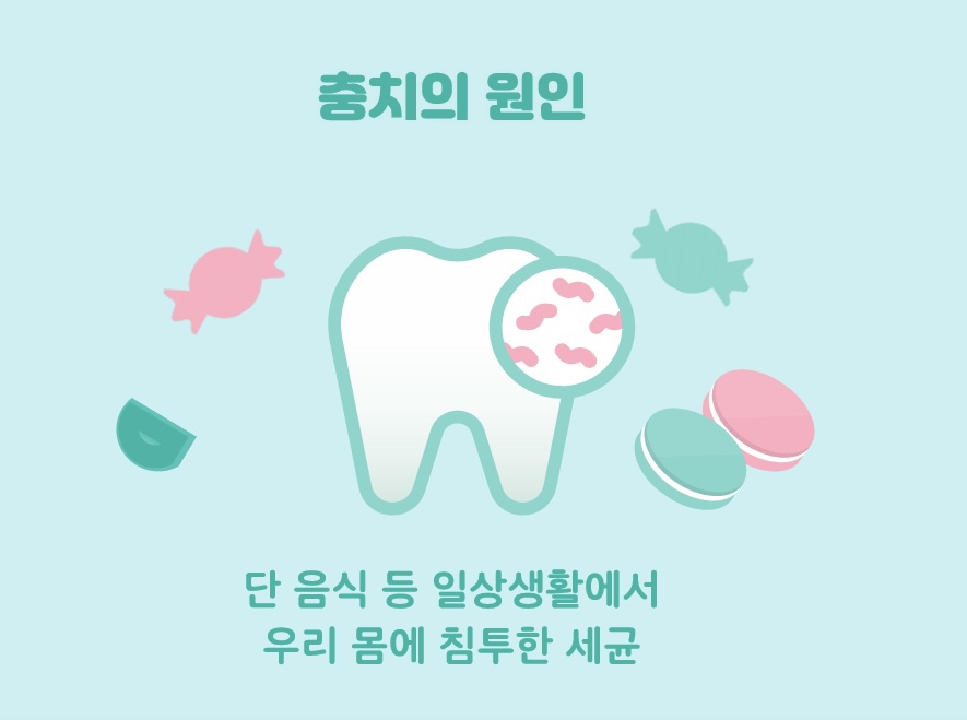 Cavities: Why Do They Form, and How Are They Treated? image 2