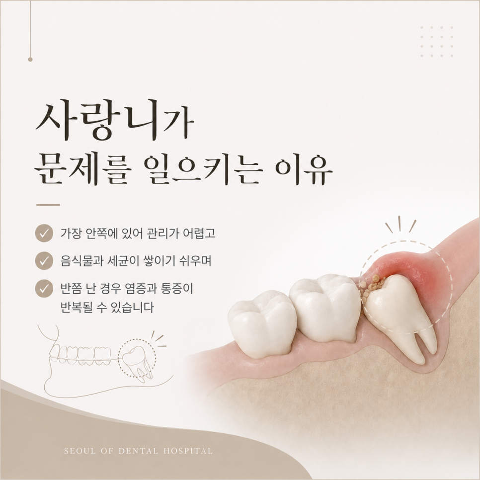 Samjeon Station Dental Clinic: Do Wisdom Teeth Have to Be Removed? Cases Where Extraction Is Necessary image 2