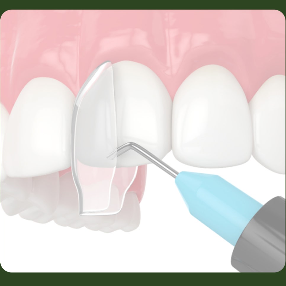 Causes of Resin Discoloration: Let’s Learn Together! image 3