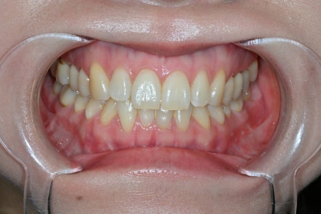 Why Obzero Laminates Look Naturally Beautiful image 10