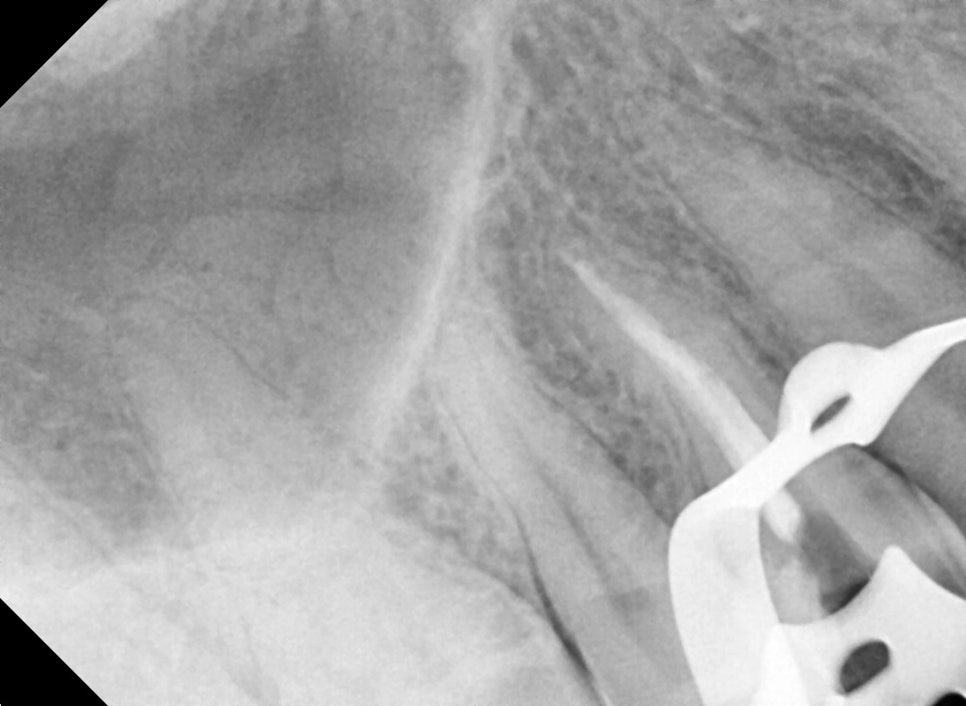 Found a Dental Clinic That Can See Patients on Sundays! Convenient for Patients with Rhinitis and Asthma image 4