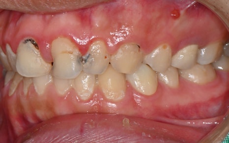 [Seokchon Station Dental Clinic] Overcoming Dental Phobia with Evening and Sunday Treatment! image 4