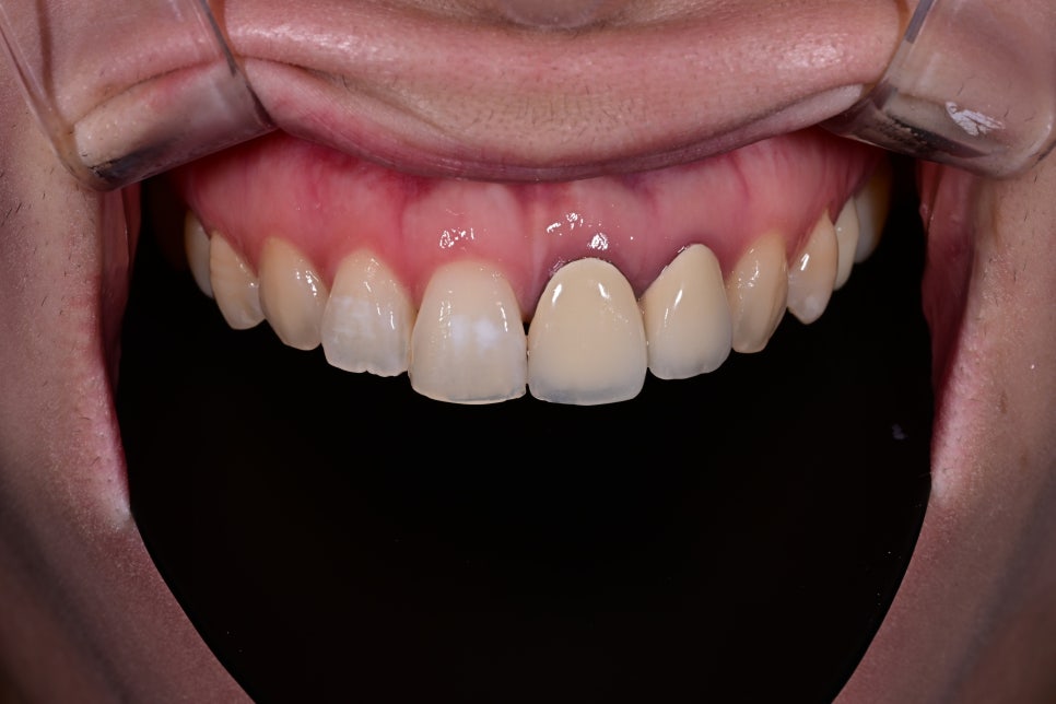 Key Criteria to Know Before Comparing Laminate Prices | OBZERO image 3