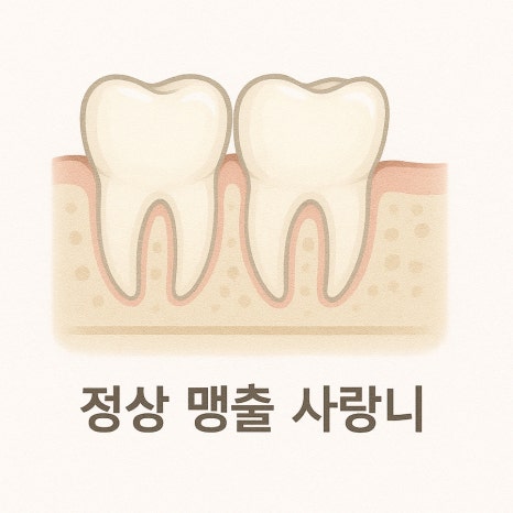 How to Care for Your Mouth After Wisdom Tooth Extraction image 3