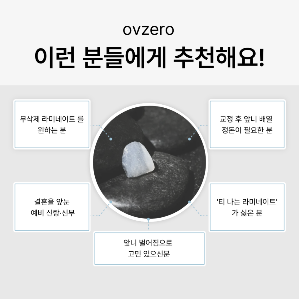 Why the Front Teeth Laminate Changed Naturally with Obzero Laminate image 13