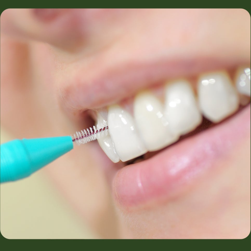 Interdental Brush Sizes: Choose the Right One for You! image 5