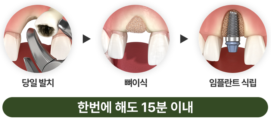 Implant Reoperation: Don’t Give Up. image 1