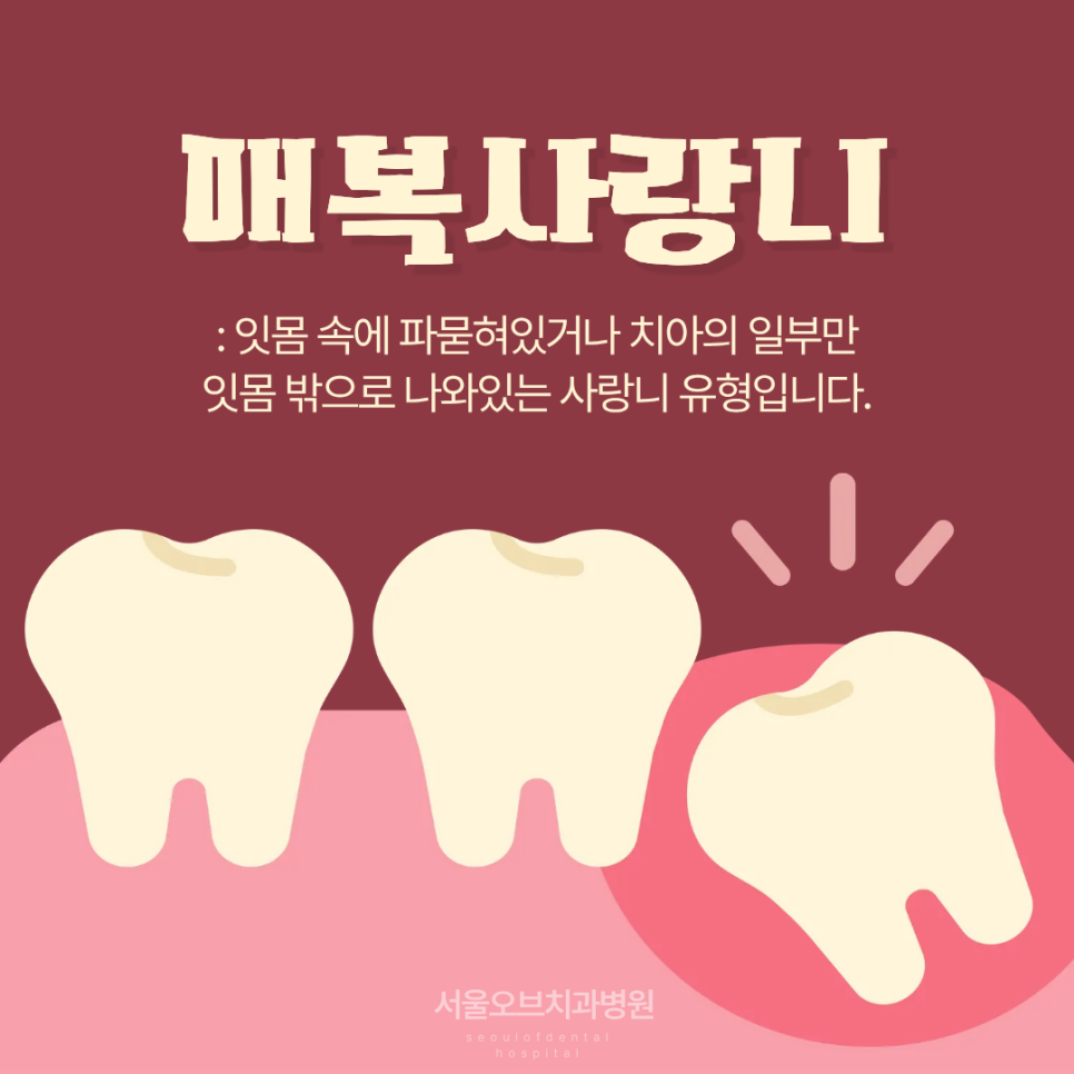 Jamsil Wisdom Tooth Extraction: If It Doesn’t Hurt, Is It Okay to Keep Putting It Off? image 6