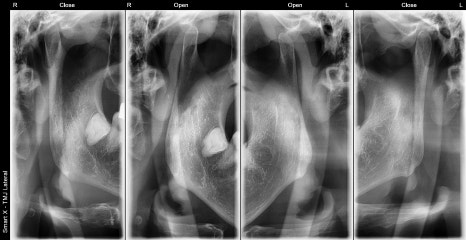 Clicking in the Jaw? A TMJ Treatment Clinic with an Oral and Maxillofacial Surgeon from Seoul National University image 3