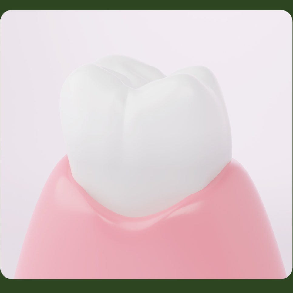 Causes of Resin Discoloration: Let’s Learn Together! image 4