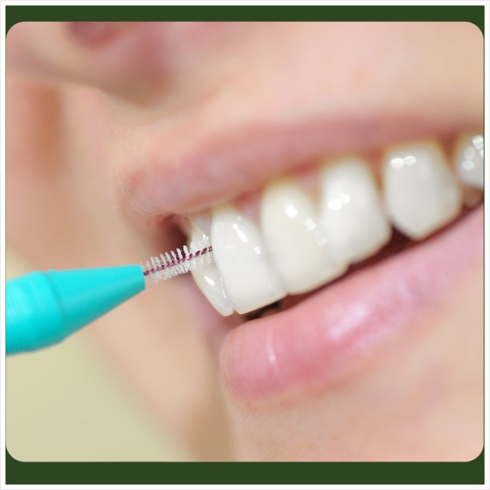 Do Interdental Brushes Need to Be Thrown Away After One Use? image 2