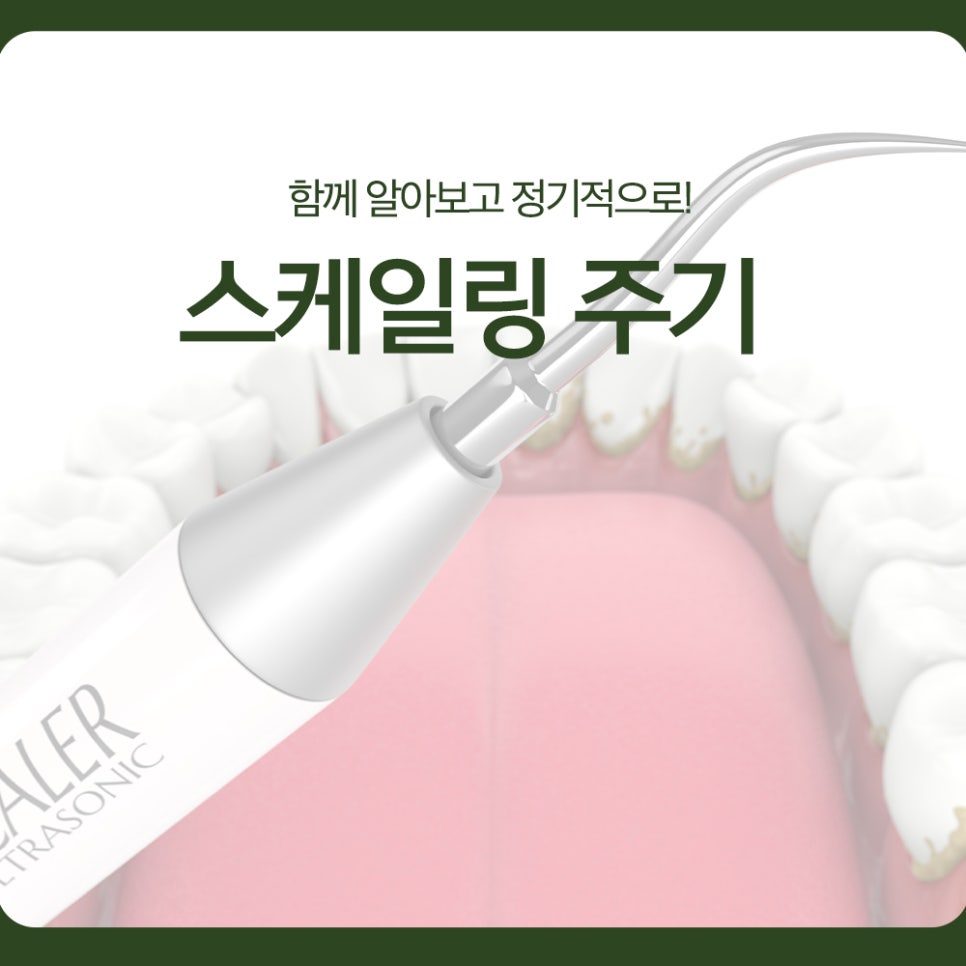 Scaling Frequency: Let’s Learn Together and Keep Up with Regular Visits! image 1