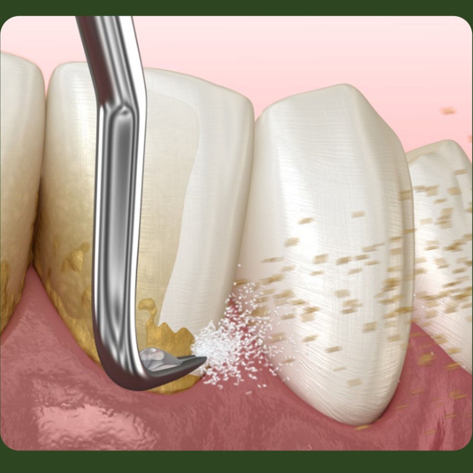 Regular Dental Checkups, Consistently for Healthy Oral Care image 5