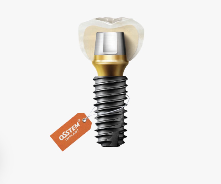 A 90s Senior Who Was Curious About Implant Insurance Pricing: How Did the Treatment Proceed? image 10