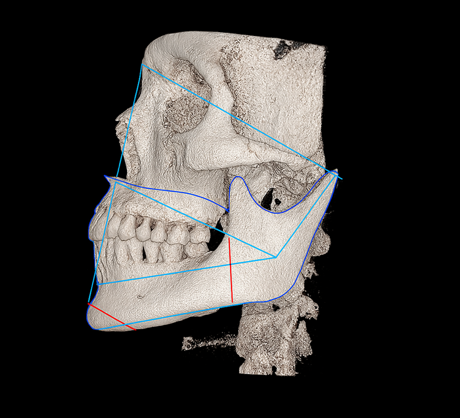 Jaw Joint Pain Gets Worse if You Leave It Untreated image 3