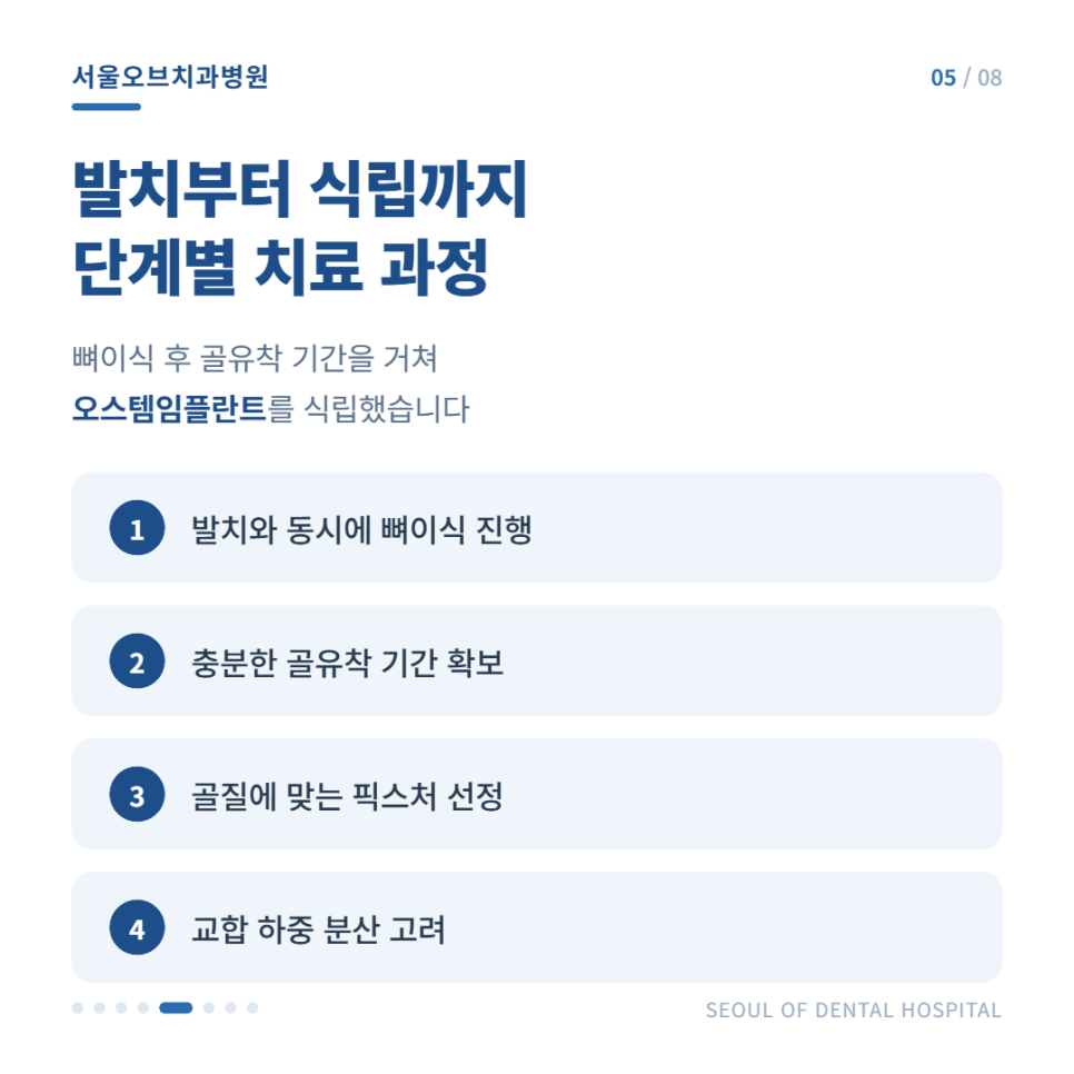 잠실임플란트 치주염으로 흔들리던 어금니, 오스템임플란트 수복 사례 관련 이미지 6
