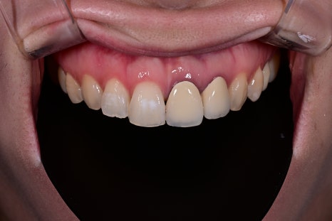 Key Criteria to Know Before Comparing Laminate Prices | OBZERO image 19