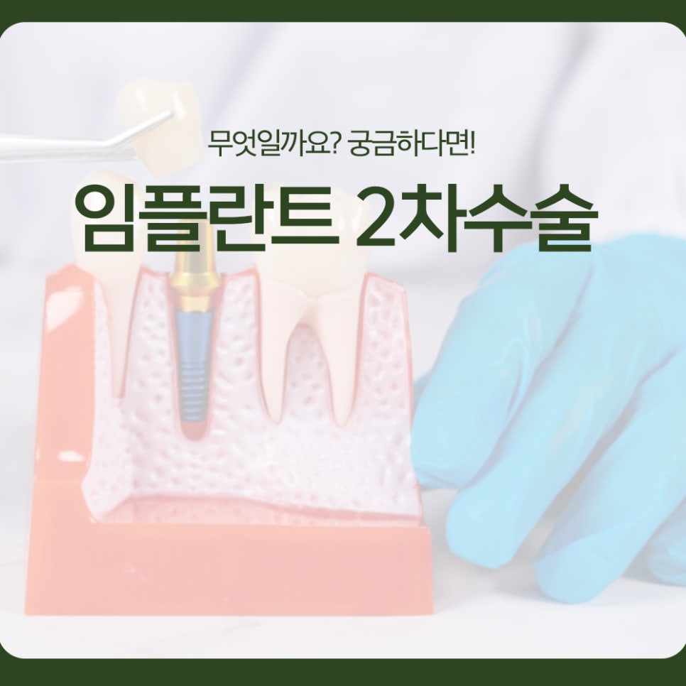What Is Second-Stage Implant Surgery? Find Out Here! image 1