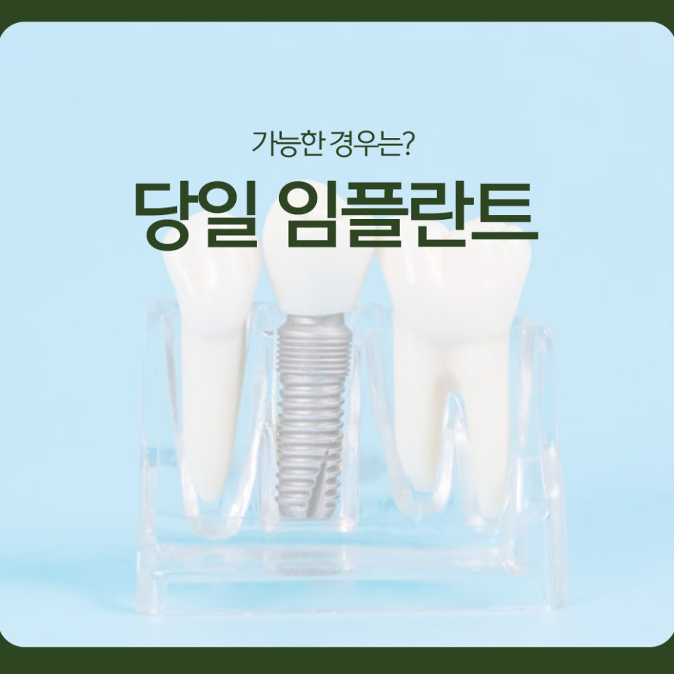 When Is Same-Day Implant Treatment Possible? image 1