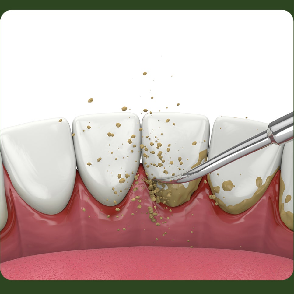 Scaling Frequency: Let’s Learn Together and Keep Up with Regular Visits! image 4