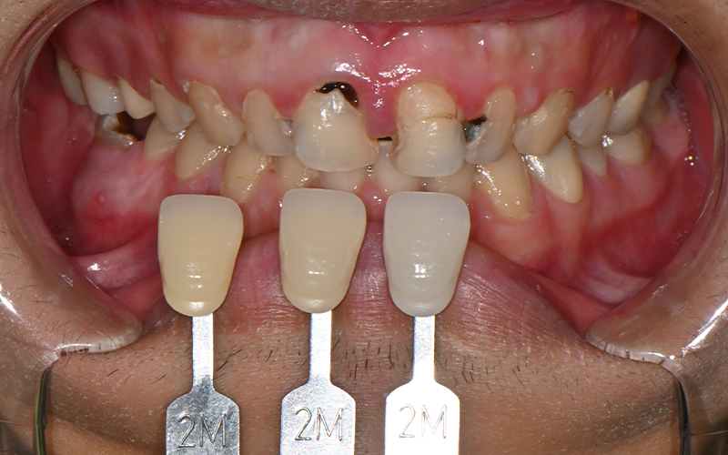 [Seokchon Station Dental Clinic] Overcoming Dental Phobia with Evening and Sunday Treatment! image 8