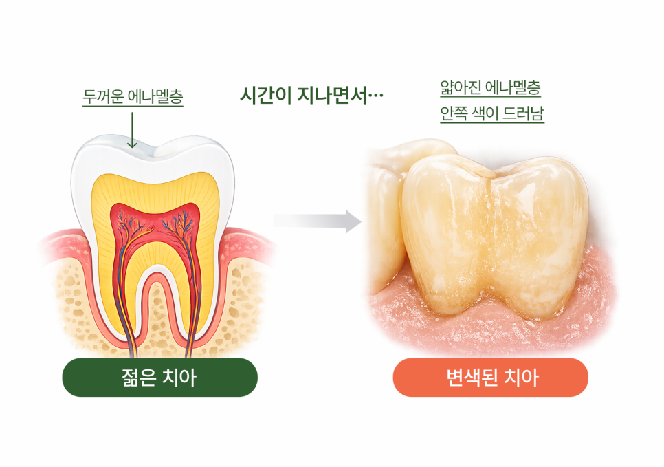 Objeo Laminate Cost, Treatment Review from a Woman in Her 20s image 3