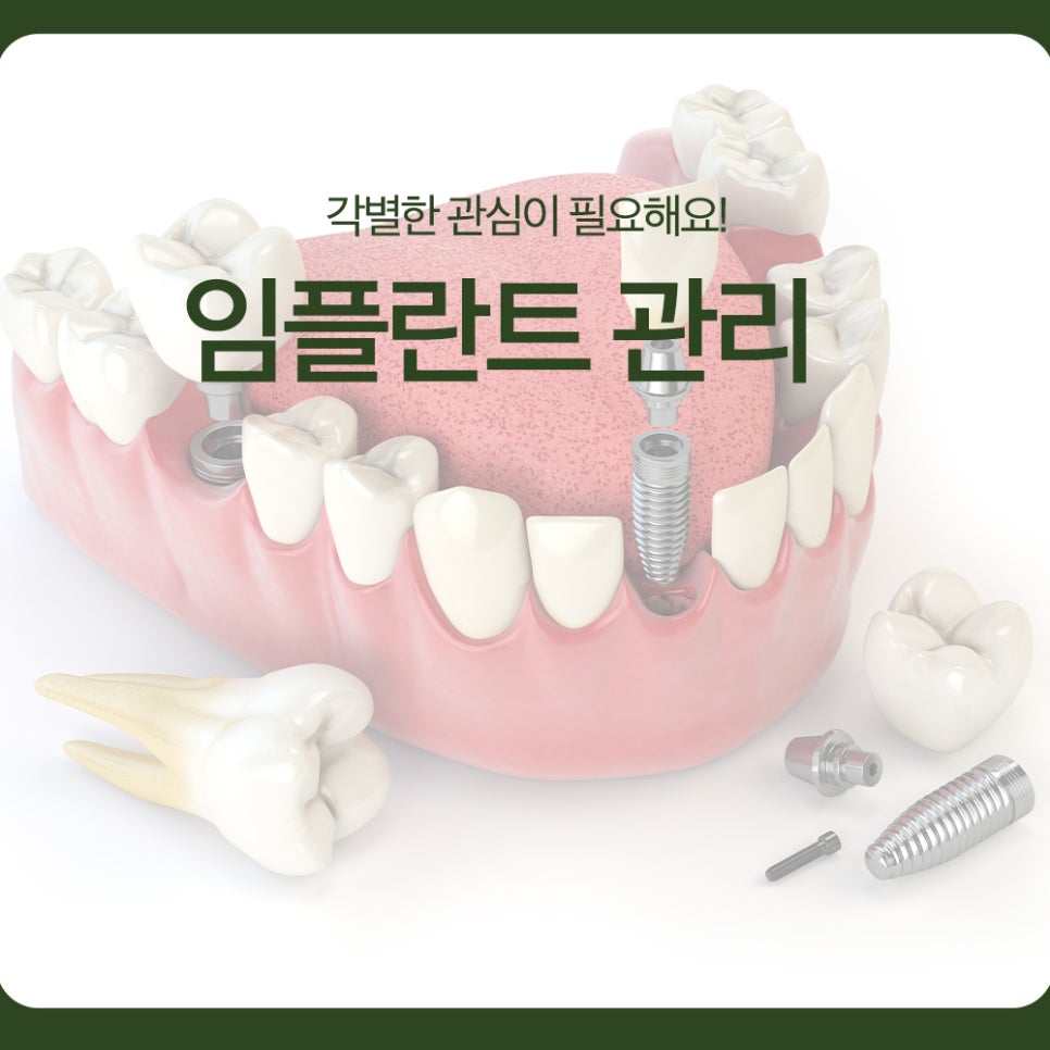 Implant Care Needs Special Attention! image 1