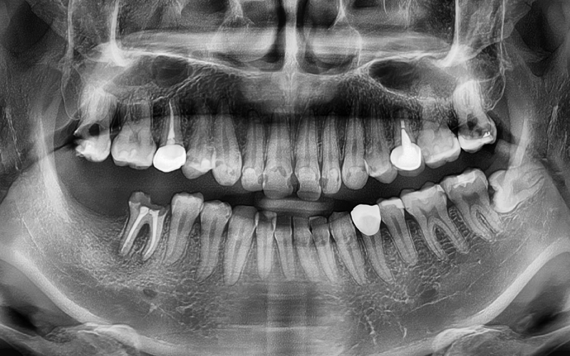 [Seokchon Station Dental Clinic] Overcoming Dental Phobia with Evening and Sunday Treatment! image 6