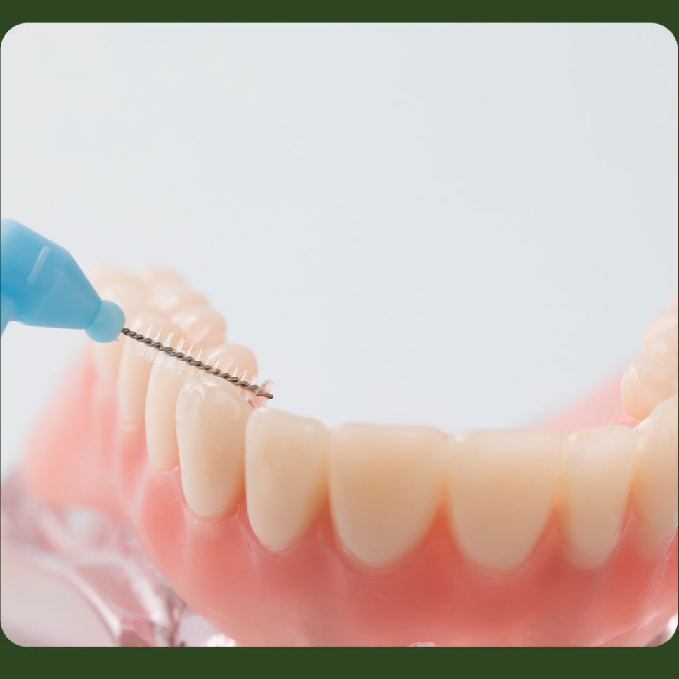 Interdental Brush Sizes: Choose the Right One for You! image 2