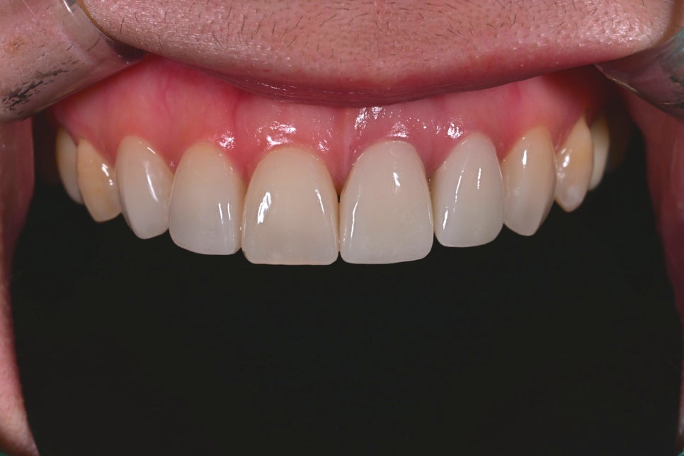 Key Criteria to Know Before Comparing Laminate Prices | OBZERO image 4