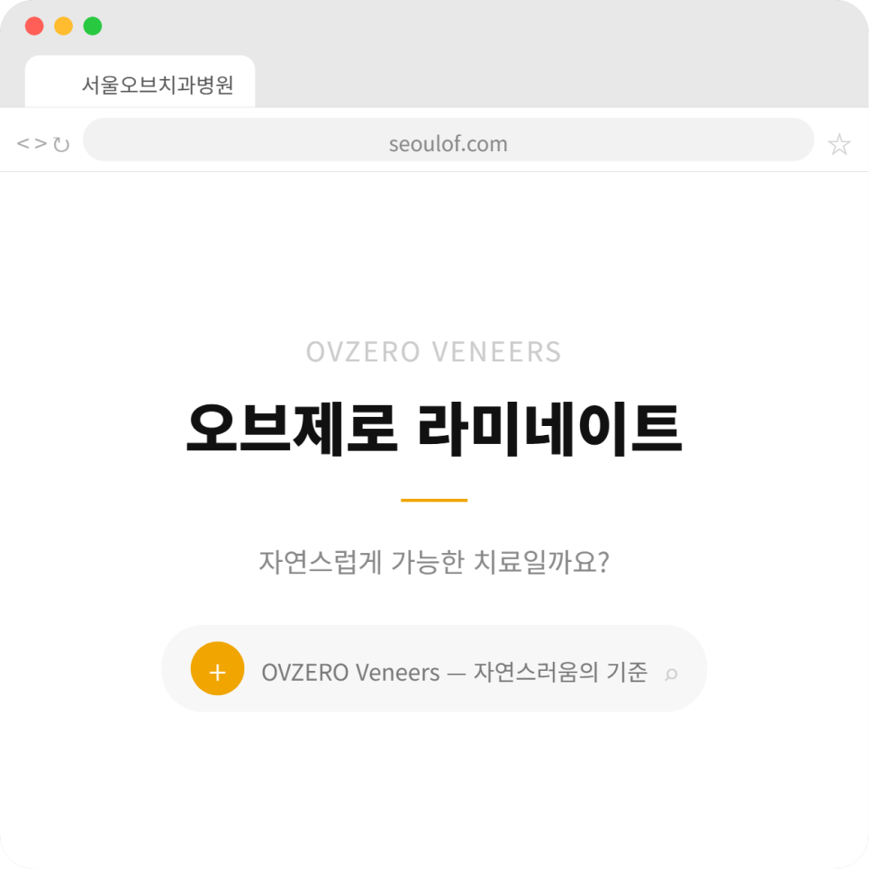 오브제로라미네이트, 무삭제라미네이트 자연스럽게 가능할까?(OVZERO Veneers, Is No-Prep Veneer Really Possible?) 관련 이미지 1