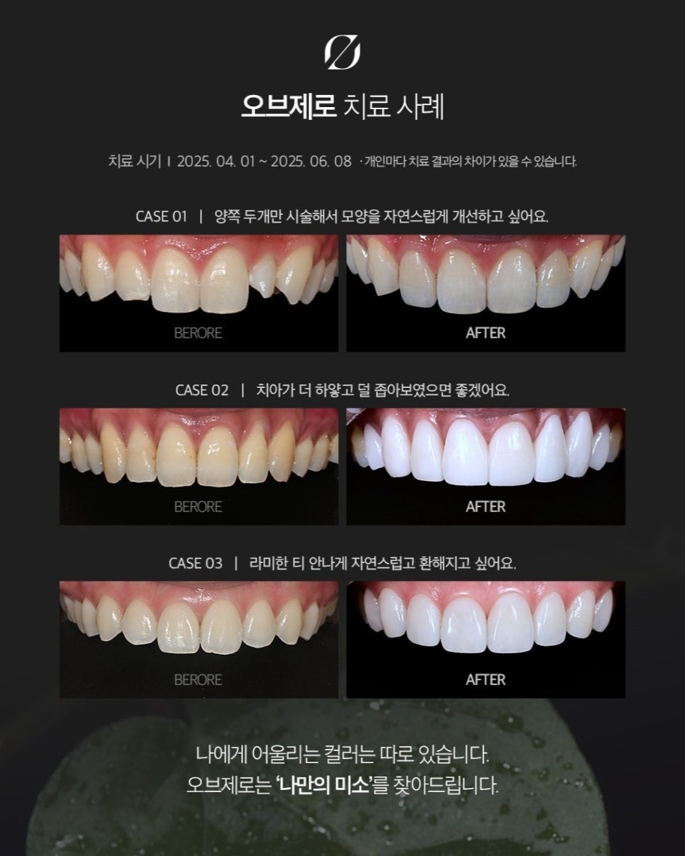 Jamsil Laminate Review | Interview on Ob제로 No-Prep Laminate image 15