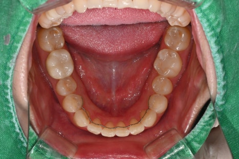 Key Criteria to Know Before Comparing Laminate Prices | OBZERO image 25