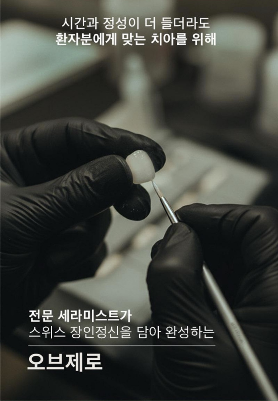 Jamsil Laminate: Cases Where Treating Just a Few Front Teeth Is Enough image 8