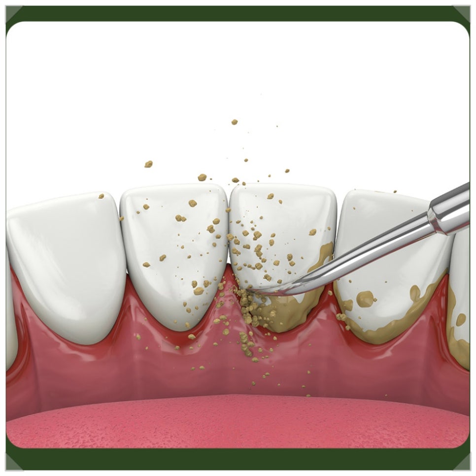 Let’s Clear Up Misconceptions About Scaling Together! image 3