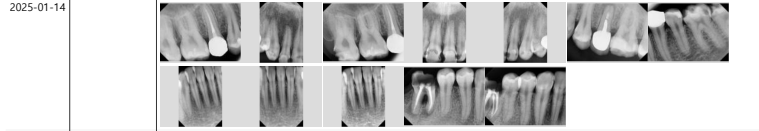 [Seokchon Station Dental Clinic] Overcoming Dental Phobia with Evening and Sunday Treatment! image 5