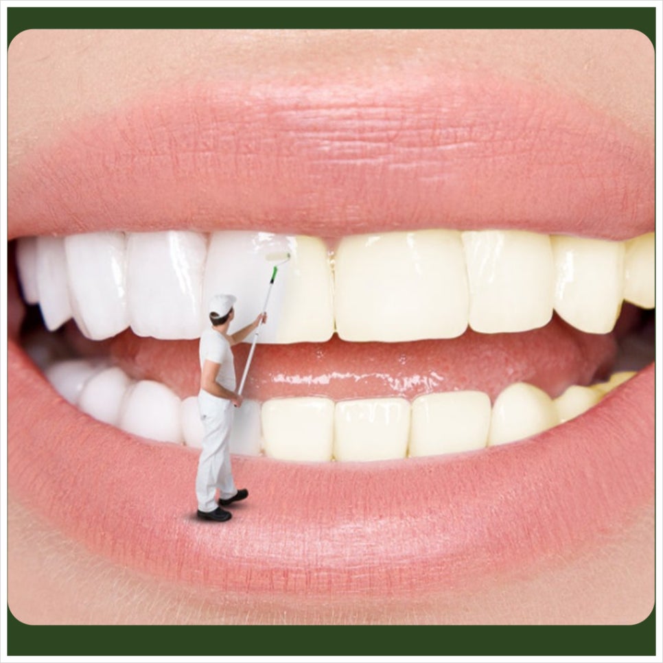 Can I Drink Coffee After Teeth Whitening? image 4