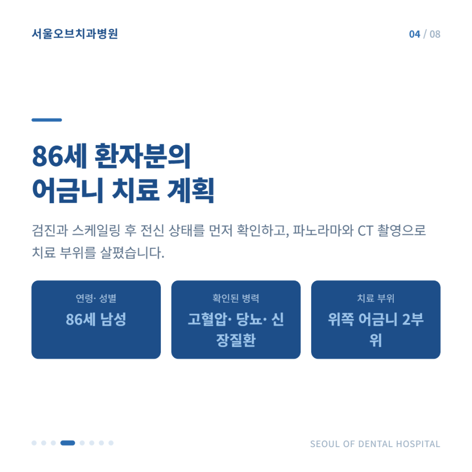 잠실치과 치매 임플란트 고령임플란트 가능할까? 관련 이미지 10