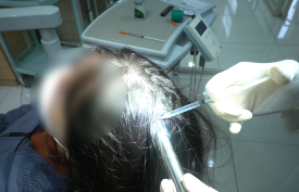 Female Hair Loss: What Symptoms Appear and How Should It Be Managed? image 3