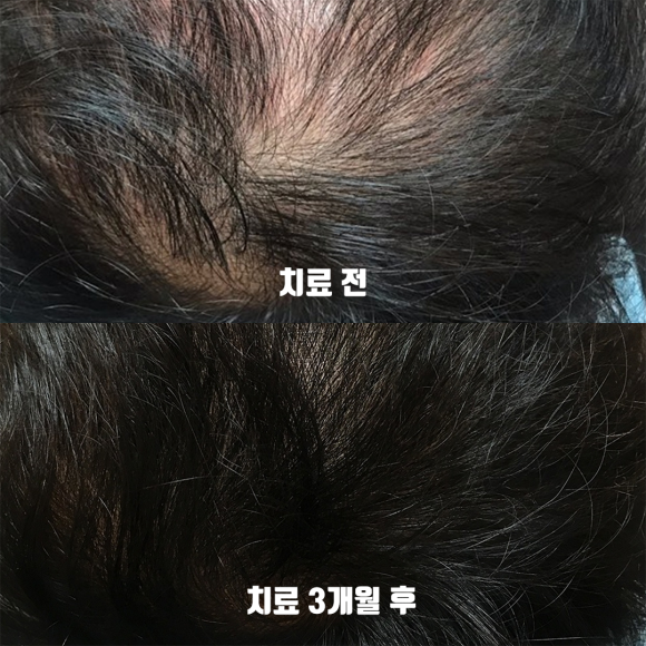 [뉴헤어] 관련 이미지 1
