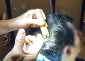 중년탈모관리, 치료를 고민할 때 무엇부터 살펴봐야 할까? 관련 이미지 7