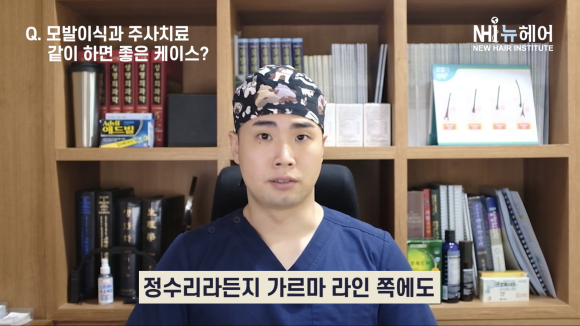 모발이식과 탈모주사치료 같이 하면 좋은 경우? #정수리 #탈모 #모낭주사 #엑소좀 #모발이식 관련 이미지 3