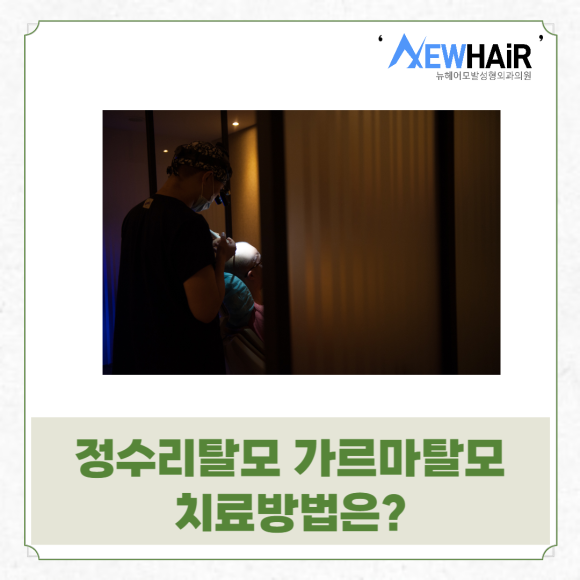 정수리 가르마탈모 더 늦기 전에 탈모주사관리 관련 이미지 2