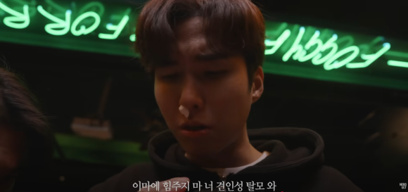 팔이 부러져도 병원 안 가던 그가, 탈모로 왔다 관련 이미지 5