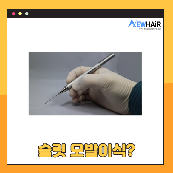 모발이식병원추천 알아봐야 할 것은 관련 이미지 3