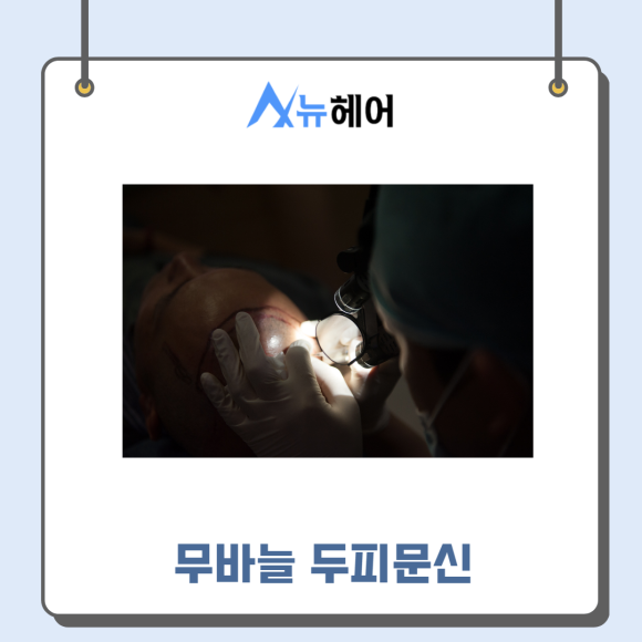 두피문신가격과 따져봐야 할 것은? 관련 이미지 3